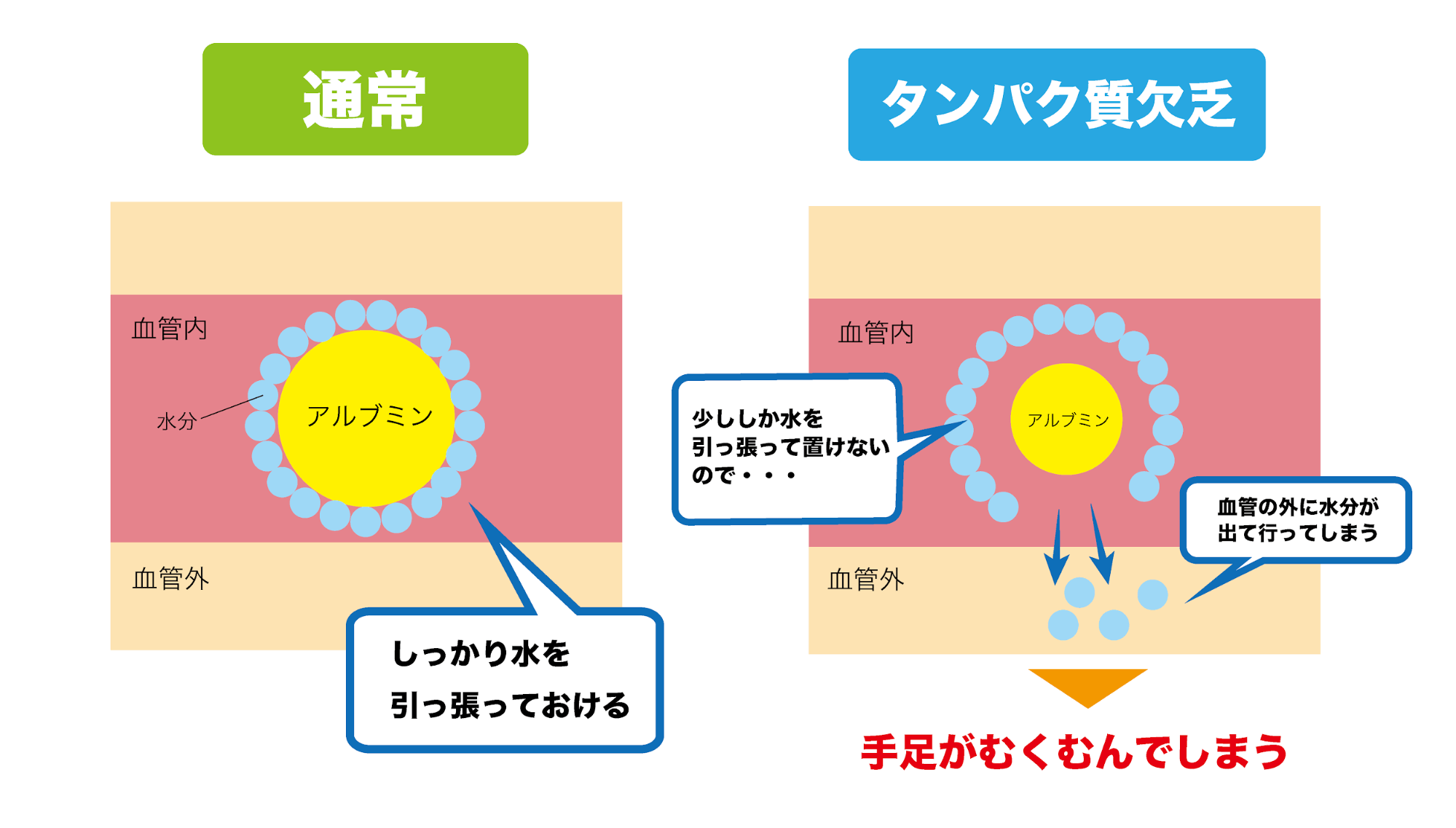 ▲浮腫みや脱水症状の現れ