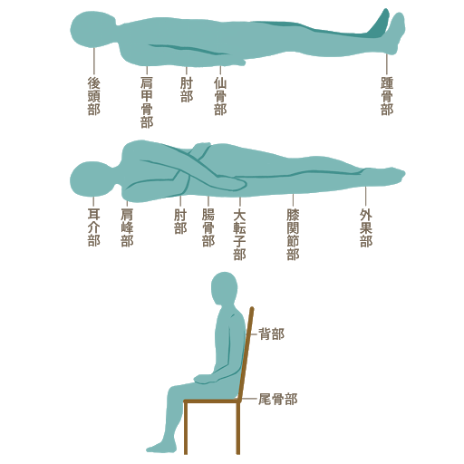 褥瘡の好発部位